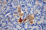 BCL2L13 Antibody in Immunohistochemistry (Paraffin) (IHC (P))