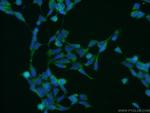 CAD Antibody in Immunocytochemistry (ICC/IF)