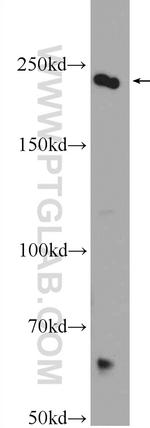 CAD Antibody in Western Blot (WB)