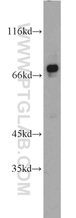 ZNF143 Antibody in Western Blot (WB)