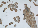 ME1 Antibody in Immunohistochemistry (Paraffin) (IHC (P))