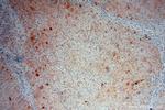 ME1 Antibody in Immunohistochemistry (Paraffin) (IHC (P))