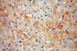 ME1 Antibody in Immunohistochemistry (Paraffin) (IHC (P))