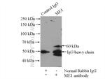 ME1 Antibody in Immunoprecipitation (IP)