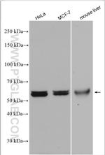 ME1 Antibody in Western Blot (WB)