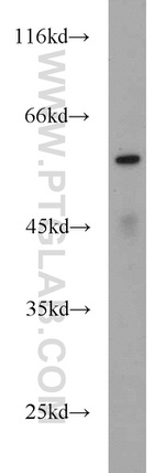 ME1 Antibody in Western Blot (WB)