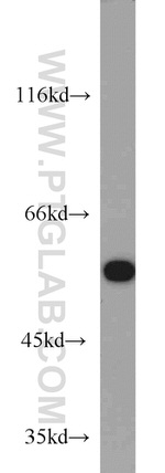 ME1 Antibody in Western Blot (WB)