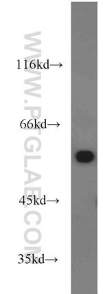 ME1 Antibody in Western Blot (WB)