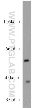 ME1 Antibody in Western Blot (WB)