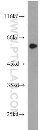 ME1 Antibody in Western Blot (WB)