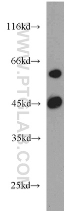 ME1 Antibody in Western Blot (WB)