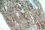 ACADS Antibody in Immunohistochemistry (Paraffin) (IHC (P))