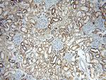 ACADS Antibody in Immunohistochemistry (Paraffin) (IHC (P))