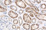 ACADS Antibody in Immunohistochemistry (Paraffin) (IHC (P))