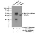 ACADS Antibody in Immunoprecipitation (IP)