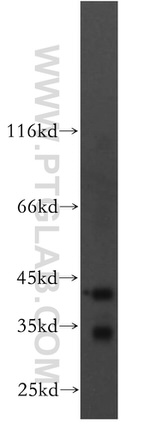 ACADS Antibody in Western Blot (WB)