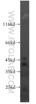 ACADS Antibody in Western Blot (WB)