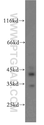 ACADS Antibody in Western Blot (WB)