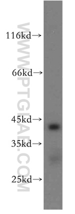 ACADS Antibody in Western Blot (WB)