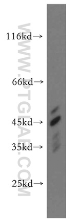 ACADS Antibody in Western Blot (WB)