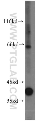 ACADS Antibody in Western Blot (WB)