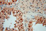 COPS7A Antibody in Immunohistochemistry (Paraffin) (IHC (P))