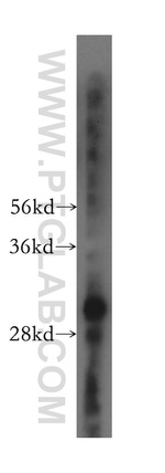 COPS7A Antibody in Western Blot (WB)