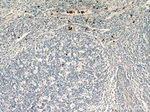 S100A12 Antibody in Immunohistochemistry (Paraffin) (IHC (P))