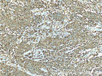 S100A12 Antibody in Immunohistochemistry (Paraffin) (IHC (P))