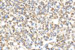 OCIAD1 Antibody in Immunohistochemistry (Paraffin) (IHC (P))