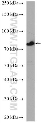 CCDC22 Antibody in Western Blot (WB)