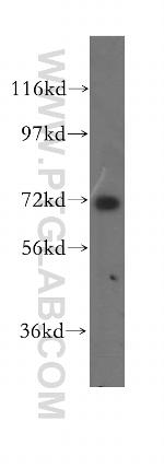 CCDC22 Antibody in Western Blot (WB)