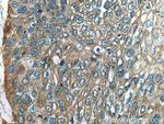 AHNAK Antibody in Immunohistochemistry (Paraffin) (IHC (P))