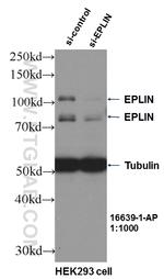 EPLIN Antibody in Western Blot (WB)