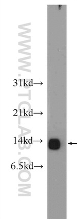 NDUFA5 Antibody in Western Blot (WB)