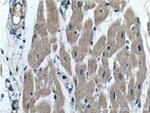 OXSM Antibody in Immunohistochemistry (Paraffin) (IHC (P))