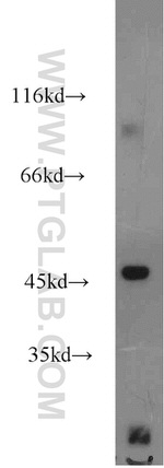 OXSM Antibody in Western Blot (WB)