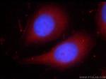 PPAR gamma Antibody in Immunocytochemistry (ICC/IF)