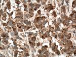 PPAR gamma Antibody in Immunohistochemistry (Paraffin) (IHC (P))