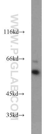 PPAR gamma Antibody in Western Blot (WB)