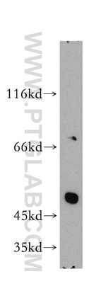 PPAR gamma Antibody in Western Blot (WB)