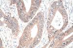 PPAR gamma Antibody in Immunohistochemistry (Paraffin) (IHC (P))