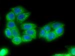 TIMP1 Antibody in Immunocytochemistry (ICC/IF)