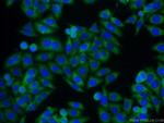 TIMP1 Antibody in Immunocytochemistry (ICC/IF)