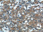 TIMP1 Antibody in Immunohistochemistry (Paraffin) (IHC (P))