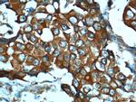 TIMP1 Antibody in Immunohistochemistry (Paraffin) (IHC (P))