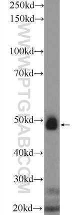 ASL Antibody in Western Blot (WB)