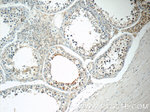 ZER1 Antibody in Immunohistochemistry (Paraffin) (IHC (P))