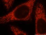 MRPL10 Antibody in Immunocytochemistry (ICC/IF)