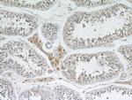 MRPL10 Antibody in Immunohistochemistry (Paraffin) (IHC (P))